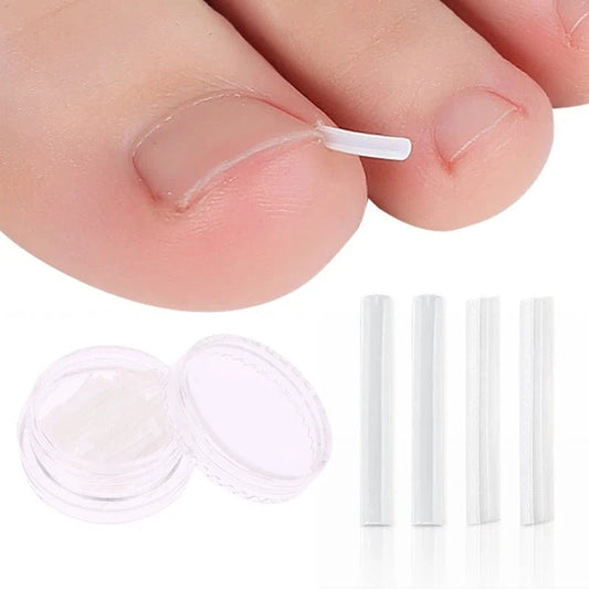 50Pc Ingrown Toenail Correction Treatment