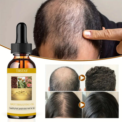 50ML Beard and Hair Growth Oil