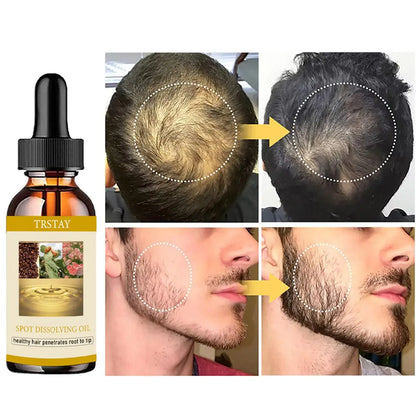 50ML Beard and Hair Growth Oil